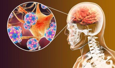 Neurodegenerative Diseases