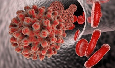 Hepatitis is a viral infection that affects the liver