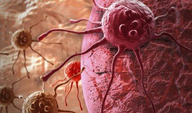 Cancer Overview and Treatment